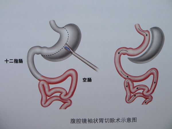 运动康复怎么选?公立医院康复科与私立专业机构各有何优势(图1)