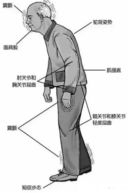 重新定义脑瘫诊疗黄金期！国内首部脑瘫诊断定义共识正式发布(图1)